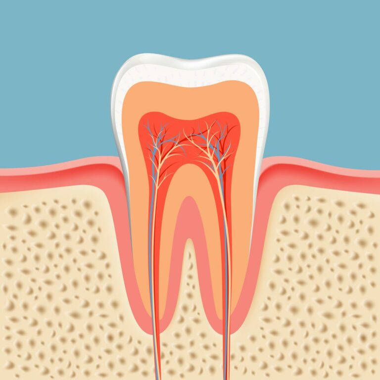 root canal treatment