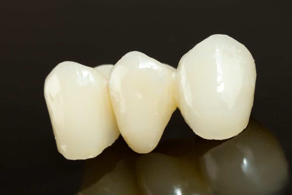 Here‘s Why You May a Need Dental Crown Treatment