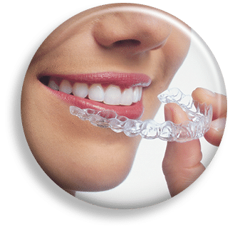 Beautiful Smile with Invisalign Treatment