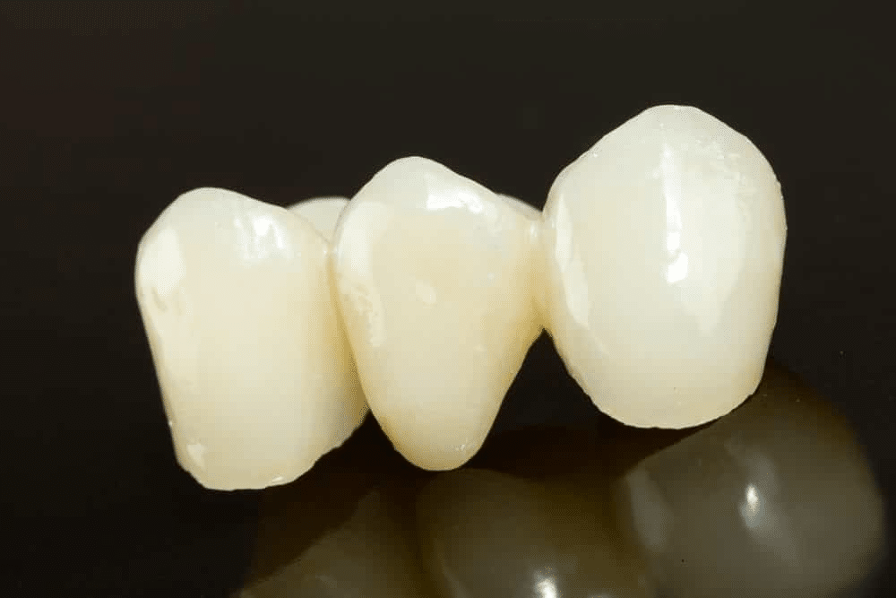 What is crown and bridge treatment in Mount Pleasant, PA, and who needs it?